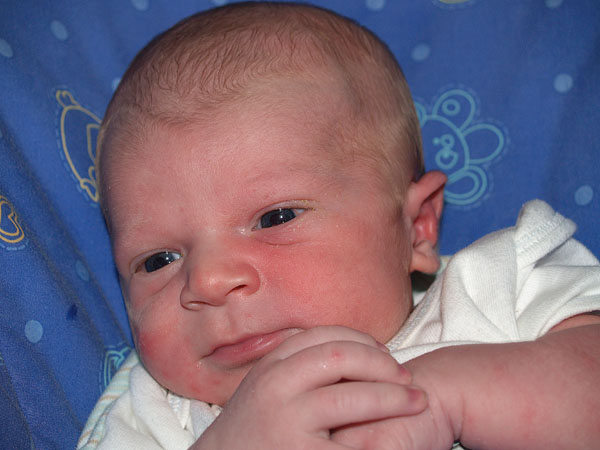 10 days old