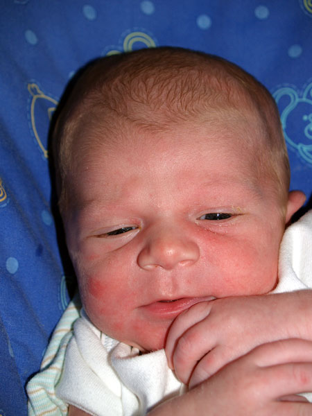 10 days old